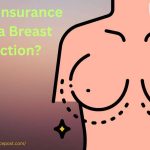 Will My Insurance Cover a Breast Reduction