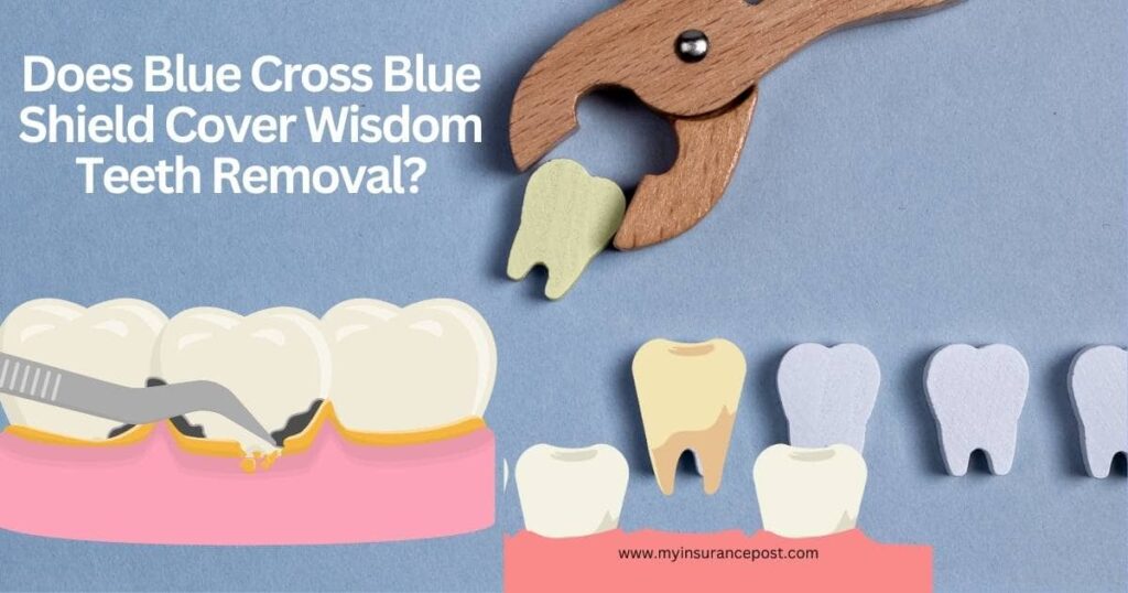 Does Blue Cross Blue Shield Cover Wisdom Teeth Removal